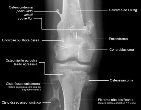 Como evitar lesões e dores musculares com alongamentos e aquecimentos?