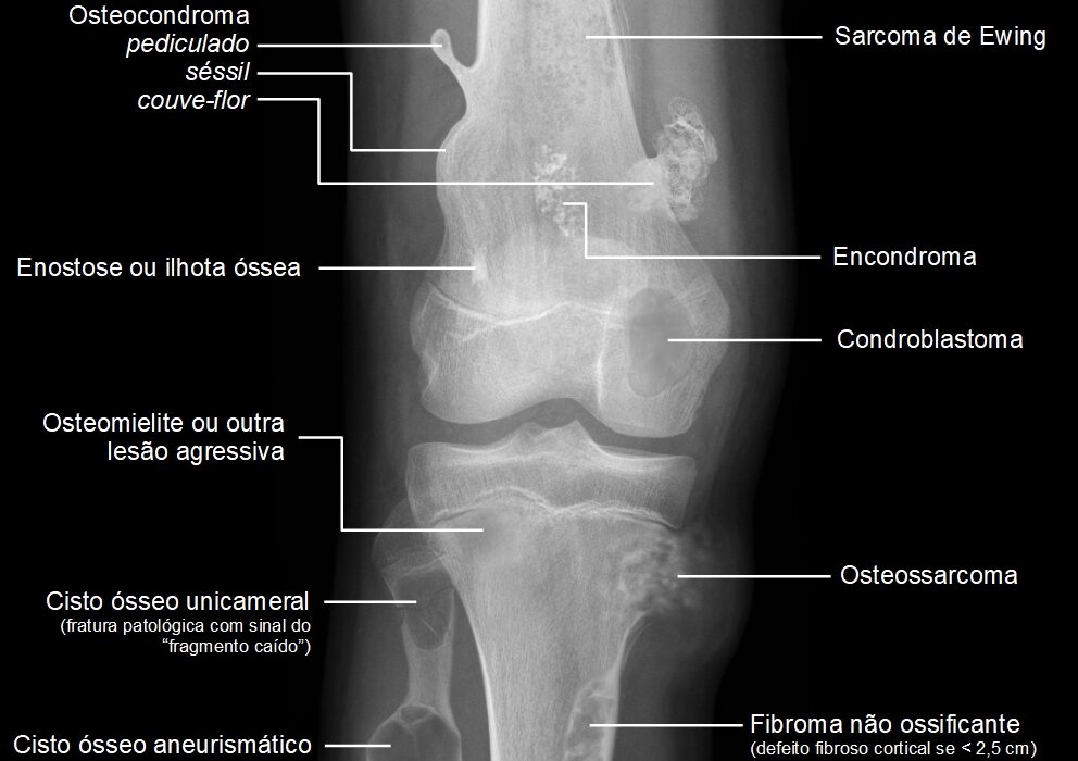 Como evitar lesões e dores musculares com alongamentos e aquecimentos?